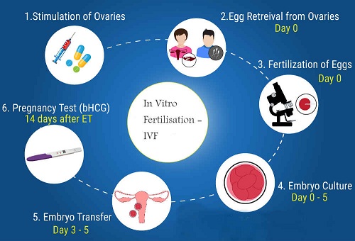 Steps in IVF steps in IVF