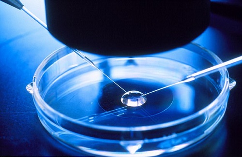 IVF cost in Bangalore IVF cost in Bangalore