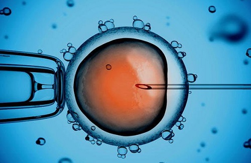 IVF treatment in India IVF treatment in India