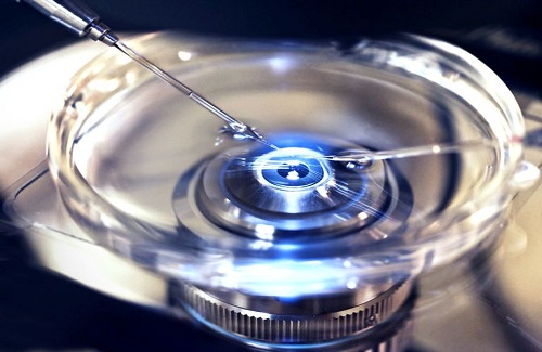 IVF cost in Delhi IVF cost in Delhi