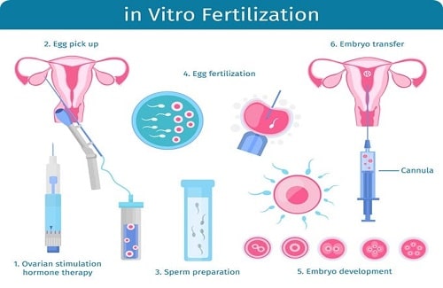 ivf process step by step ivf process step by step