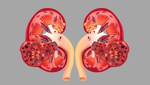 Kidney Disease