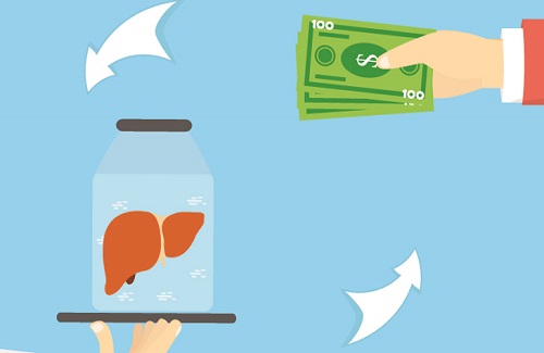 kidney transplant cost in India kidney transplant cost in India