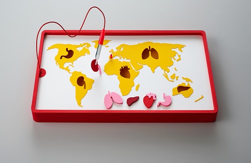 kidney transplant cost in Turkey