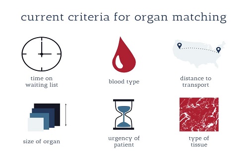 kidney transplant in Turkey