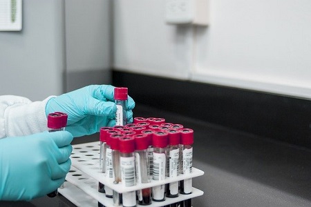 Laboratory tests