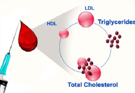 Lipid profile test cost - Vaidam Lipid profile test cost - Vaidam