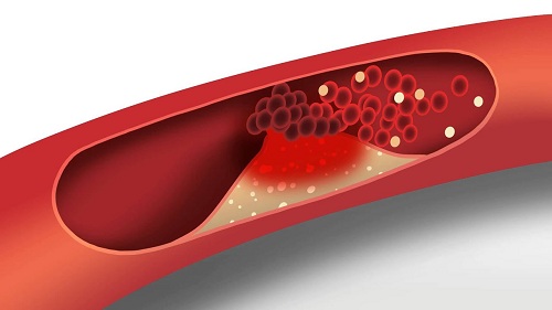 lipid profile test cost- Vaidam lipid profile test cost- Vaidam