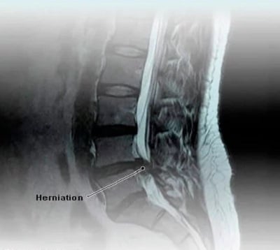 MRI scan cost - Vaidam MRI scan cost - Vaidam