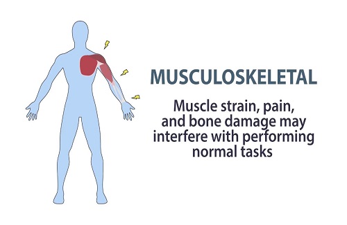 musculoskeletal disorders musculoskeletal disorders