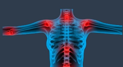 Musculoskeletal issues