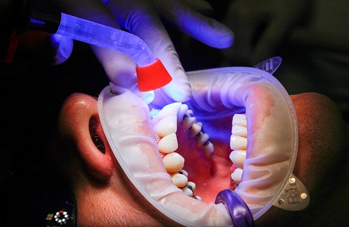 oral cancer surgery cost in india oral cancer surgery cost in india