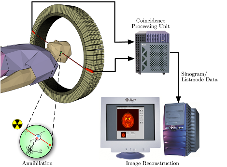 mechanism of PET scan