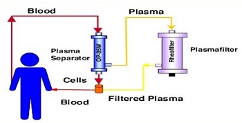 Plasmapheresis