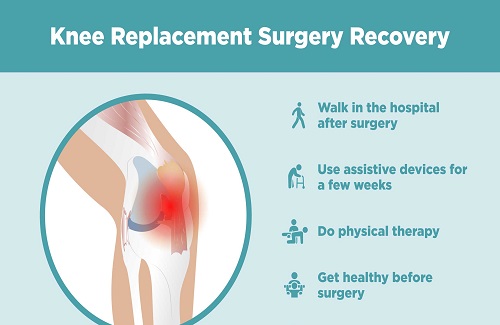 knee replacement surgery in Turkey - Vaidam Health knee replacement surgery in Turkey - Vaidam Health