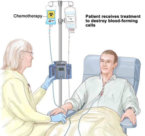 Chemotherapy