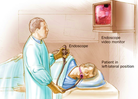 Endoscopy