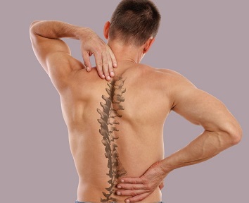 Scoliosis