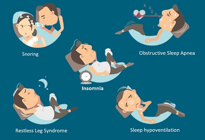 Sleep Disorders