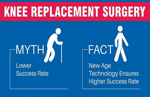 knee replacement surgery in Turkey - Vaidam Health knee replacement surgery in Turkey - Vaidam Health