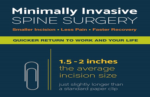 success rate of spine surgery in Turkey success rate of spine surgery in Turkey