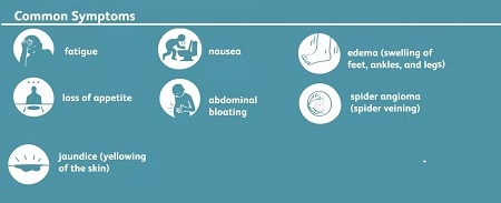 Symptoms of Cirrhosis
