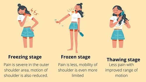 Symptoms of Frozen shoulder