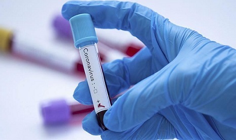 How is Coronavirus spreading?