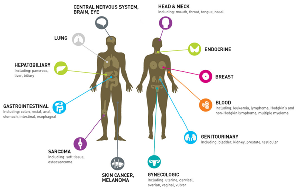 Types of Cancer