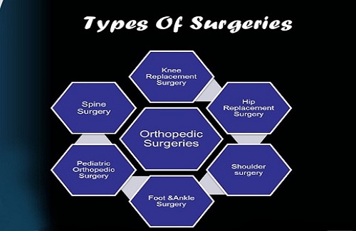types of surgeries types of surgeries