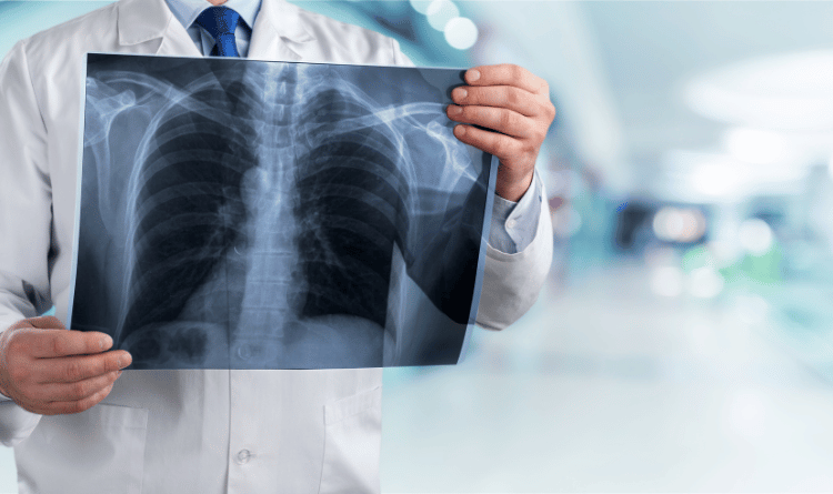 lung
