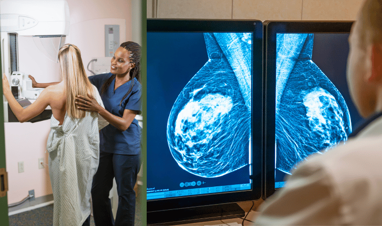 mammogram