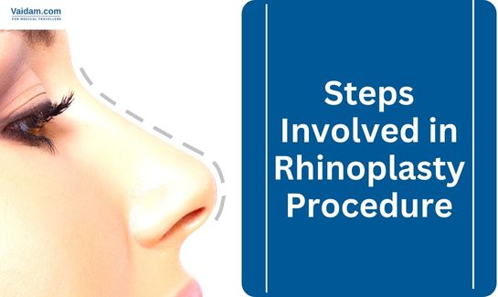 Rhinoplasty