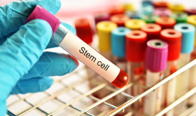Stem Cell
