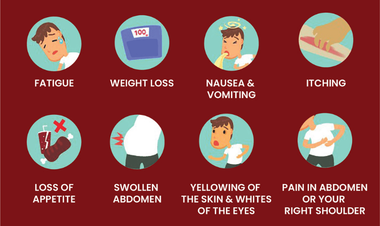 symptoms of liver cancer