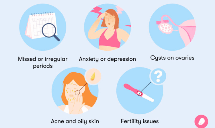 symptoms of pcos