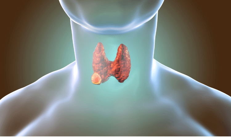 thyroid-cancer