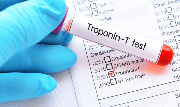 troponin test