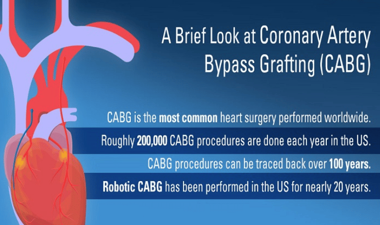 cardiac
