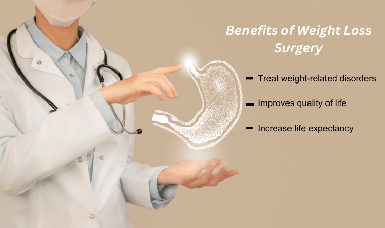 weight loss surgery benifits